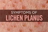 Lichen Planus: Symptoms, Causes & Treatment | BulkSupplements.com