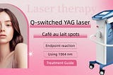 Q-switched ND YAG laser treatment for Café au lait spots
