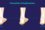 Mastering Supination: Understanding and Managing Outward Foot Roll for Optimal Health