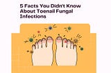 5 Facts You Didn’t Know About Toenail Fungal Infections