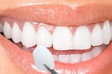 Colorado Springs Porcelain Dental Veneers A New Smile