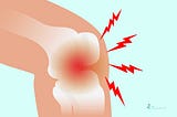 Gout in Knee Treatment: Rapid Relief Strategies