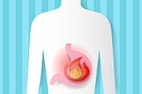 Know more about Reflux/ Heartburn/ GERD