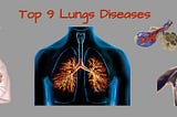 Top 9 Lungs Diseases