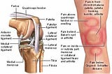 total knee replacement surgery cost, knee transplant surgery