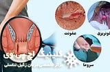 درد هنگام دفع مدفوع به دلیل یبوست