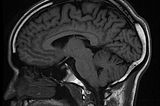 Ultra-High Fields (UHF) Human MRI: Living Brain imaged with 11.7 Tesla MRI of Iseult Project