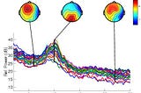 Your Guide To Preprocessing EEG data in EEGLab