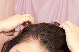 I Got Scalp Injections For My Thinning Hair — & This Is What Happened