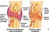 Improving Bone Fracture Recovery via A Nanofibrous Scaffold
