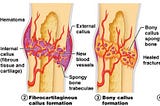 Improving Bone Fracture Recovery via A Nanofibrous Scaffold