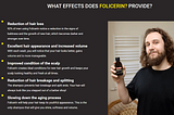 Folicerin: The Ultimate Solution to Hair Loss