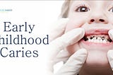 Early Childhood Caries — Causes & Preventions to Take Care of Child’s Oral Health