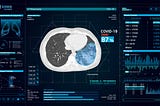 AI Can Now Detect COVID-19 in Your Lungs