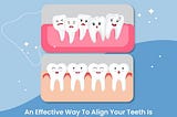 Teeth cleaning cost in Bangalore