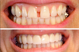 Cosmetic Dentistry in Lucknow | Best Cosmetic Dentistry Treatment