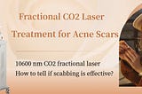 Fractional CO2 laser machine best laser treatment for acne scars