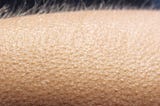 What are GooseBumps? — The Prodigious