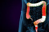 Essential Tips for Managing Large and Small Intestine Diseases