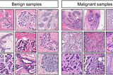 Classifying Malignant and Benign Breast Tumours with a Neural Network