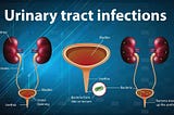 UTI vs STD: Key Symptoms to Tell Them Apart