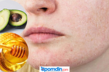 At home remedies for dry skin on face