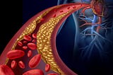 Cardiovascular Diseases in Yemen