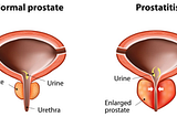 What is Gorilla Flow Prostate?