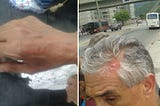 “Por escuálidos” asaltan a firmantes en autobuses que iban a Macarao