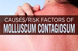 Molluscum Contagiosum: Symptoms, Causes & Treatment