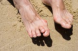 Correcting a Hammer Toe: Treatment Options and Prevention Tips