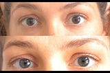 Change Eye Color Permanently With Laser Procedure