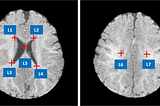 MRI Cross-Modality Image-to-Image Translation with CycleGAN