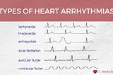 Types of Heart Arrhythmias by Best Heart Arrhythmia Specialist in India