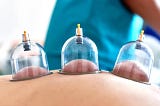 What Are The Necessary Preparations Before Hijama Cupping Therapy?