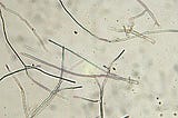Is Mold a Fungus or Bacteria? Understanding the Science Behind Mold
