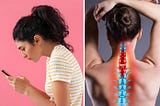 Our Phone Usage Is Gifting Us ‘Text Necks’ Now: What Are They?
