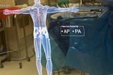 Visualizing Surgical Site Markings in AR: Part 2