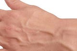 What Causes Hand Veins To Bulge?