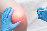 How Do I Know If I Need a Cortisone Shot?