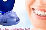 How Does Invisalign Move Teeth Best Guide