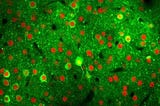 Neuroplastic Compensation: How the Brain Maintains Function Despite Neuronal Loss