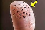 Man Has Weird Round Spots On Finger When The Doctors See It They Call The Cops