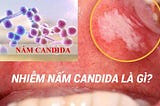 [ Nấm Candida ] Tìm hiểu nguyên nhân gây bệnh và cách chữa trị