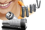 Cấy ghép Implant Pháp có tốt không?