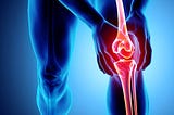 What You Should Know About Knee Replacement Surgery — Factors to Consider