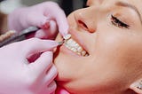 Why Are My Teeth Chipping: Exploring Different Reasons