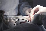 Close up detail of a surgery on male genitals with the professional equipment. Surgeons in sterile suits performing medical procedure, process of prostatectomy (prostate surgery).