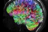 7 Neuroplasticity Tricks to Make Your Brain Do Hard Things