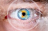 How LASIK Eye Surgery Works